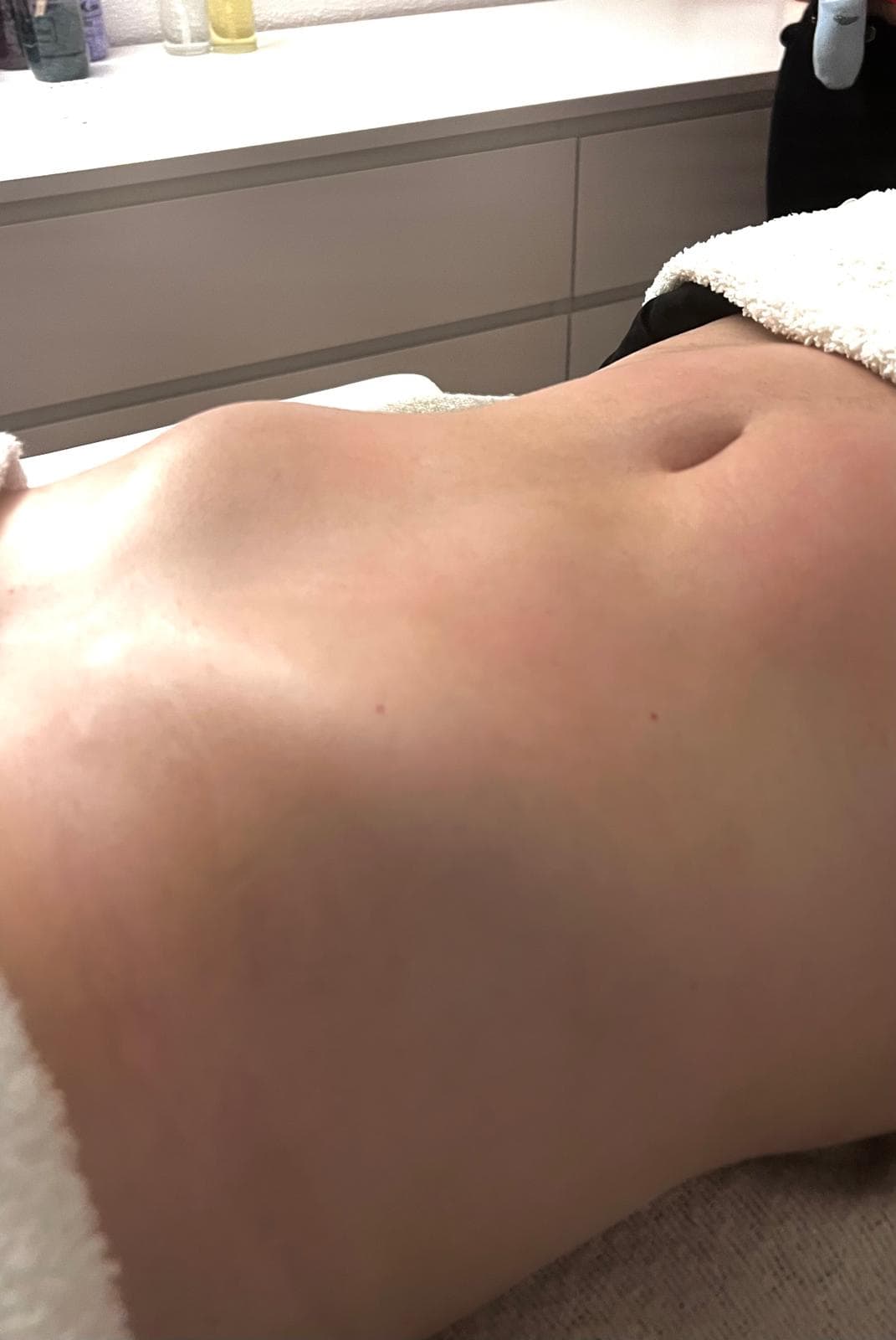 Massagem Redutora — Depois